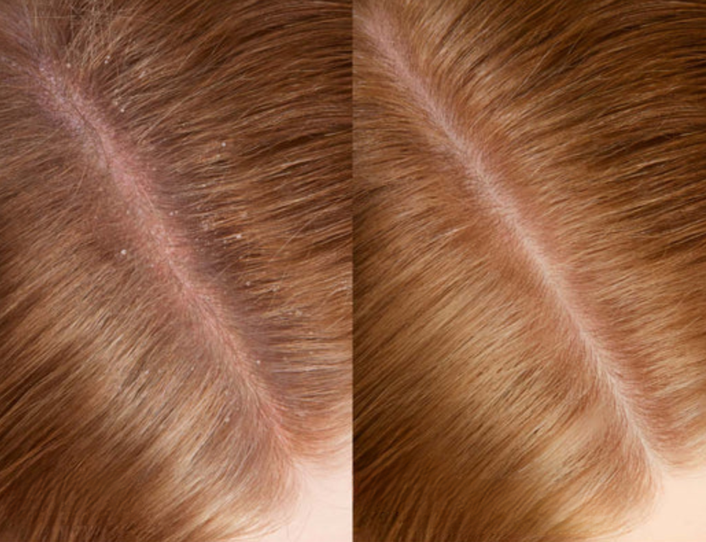 Before and After comparison