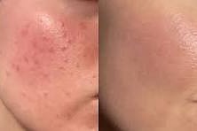 Before and After comparison